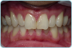 cosmetic-dentist