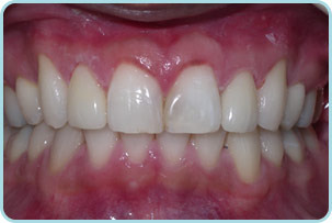 cosmetic-dentist-after
