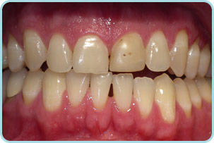 cosmetic-dentistry