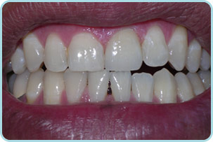 cosmetic-dentistry-after