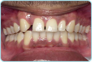 cosmetic-dentistry