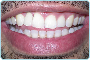 cosmetic-dentistry-after