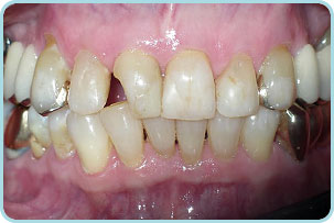 cosmetic-dentistry