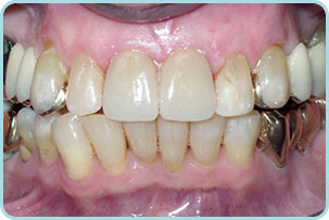 cosmetic-dentistry-after