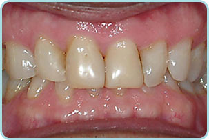cosmetic-dentistry